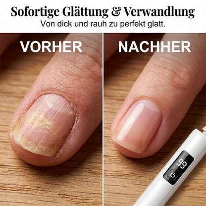 💎 ✨Professionelle elektrische Nagelfeile